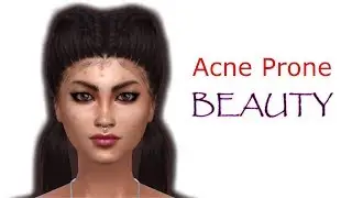 The Sims 4 Create A Sim: Acne Prone Beauty