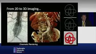 Image-Guided Therapy Innovations: Centerline, FORS, CYDAR & Others | Dr. Alam Lumsden at TED 2024