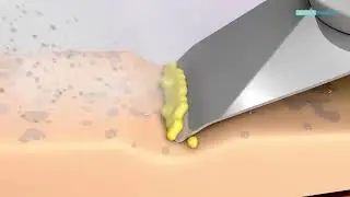 Shape Tactics 8-in-1 Hydro Dermabrasion & Skin Analysis System | SRCMAF1337