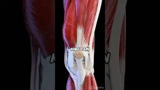 Fix Your Knee Pain (DOCTOR EXPLAINS)