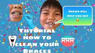 How to clean your Braces Tutorial get them PERFECTLY clean II Shawn whatsoever