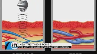 Let Pine View Medical Clinic show you they can help with E.D.
