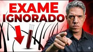 Ferritina Baixa: O Motivo Oculto Por Trás da Queda de Cabelo Que Seu Exame Não Mostra
