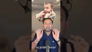 Rheumatic vs Scarlet Fever for the USMLE | HyGuru
