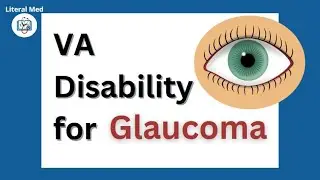 VA Disability for Glaucoma👁 #literalmed #veterans #vadisability #vaclaims #vabenefits