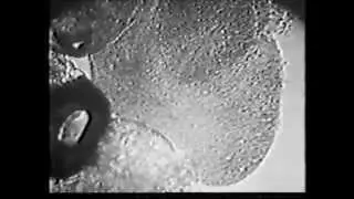 Protoplasma 1