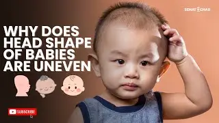 Why Does Head shape of babies are uneven |  Head Shape 🤯and Forehead Shaping #headshape #forehead