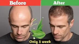 Aloe Vera + Curry Leaves: The Ultimate Hair Growth Remedy (100% Natural Results!)