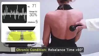 ENF - Rebalance