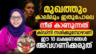 ഈ 10 ലക്ഷണങ്ങൾ അവഗണിക്കല്ലേ | കിഡ്&zwnj;നി നശിക്കുനത്തിന്റെ ലക്ഷണമാണ് | kidney failure symptoms