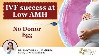 IVF success at Low AMH | No Donor Egg | Dr Rhythm Gupta - IVF Specialist in Delhi, Excel IVF