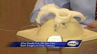 After deadly fire, NH man gets brain surgery to stop tremors