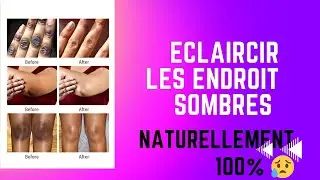 COMMENT SE D&Eacute;BARRASSER DES TACHES SOMBRES SUR LES GENOUX/COUDES/AISSELLES NATURELLEMENT 🤫🤫