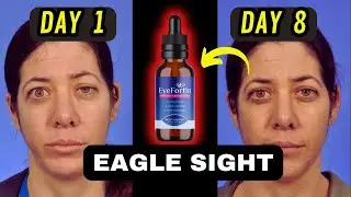 ✅| Eyefortin | Eyefortin Reviews | Eyefortin Buy | Eyefortin Order | Get Eyefortin | Eyefortin 2024