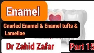 Part15 Enamel, Gnarled Enamel & Enamel tufts & Lamellae #gnarledenamel#enameltufts#enamellamellae