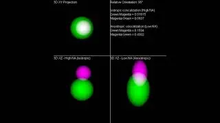 Why isotropic resolution is essential for 3D image analysis