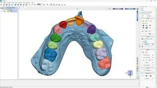 03 - Viewbox tutorial: Tooth Segmentation