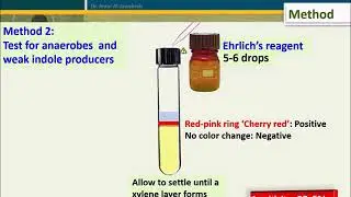 Indole test