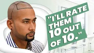Monirul's Hair transplant experience at Hair of Istanbul