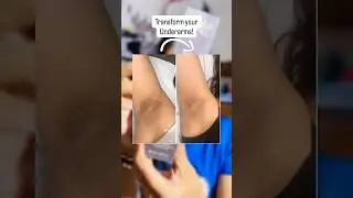 Asaya underarm spray! 💙 #shorts #underarm #darkunderarms #viral #beauty