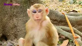 Poor orphan abandoned baby Tom broken hand & bruise eye. Tom baby urgent need help to treat injury.