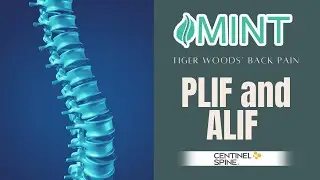 Tiger Woods&rsquo; Back Pain: PLIF and ALIF &ndash; Dr. Scott Kutz | (972) 244-3491