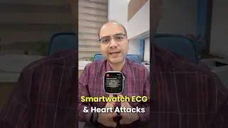 Могут ли умные часы или Apple Watch обнаружить сердечный приступ? | Объяснение кардиолога