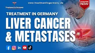 Innovative Solutions for the Treatment of Liver Cancer and Liver Metastases in Germany
