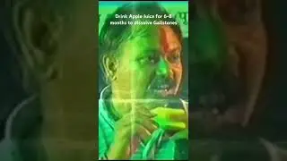 Gallbladder Stone Treatment by Rajiv Dixit || Ayurveda