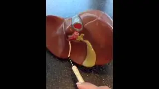Model of the liver