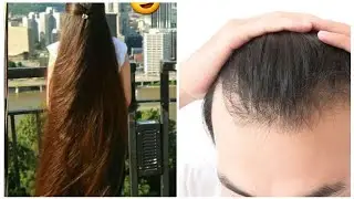 പെട്ടെന്ന് മുടി വളരുന്ന ഒരു ടിപ്പ് ||@sunithakitchen7719