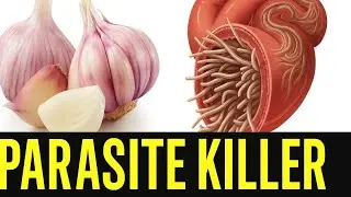 TOP 7 BEST NATURAL WAYS TO REMOVE PARASITE AND WORM FROM YOUR INTESTINES AND GUTS