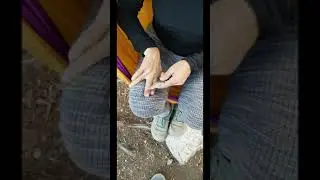 I Had to Lance My Own Infected Finger in the Wilderness 😱 | Sawtooth Backpacking Survival