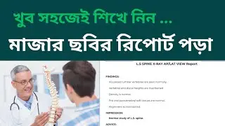 How to read LS spine report ll মাত্র 4 মিনিটে মাজার ছবির রিপোর্ট পড়া শিখে নিন
