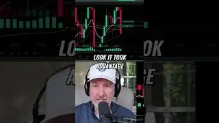 Trading Profits: From Skepticism to Shock - Real Stories! #shorts