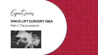 Sinuslift procedure: the main steps  | Deppeler's Expert series | Dental Microsurgery