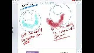 Pathology reversible cell injury