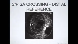 The Reorientation Technique