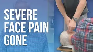 *Severe Face Pain* 😩 (Trigeminal Neuralgia) Gone 🙏 With NUCCA, NO CRACK, 🤫 Chiropractic