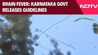 Karnataka News | Karnataka Govt Releases Guidelines For Prevention Of 'Brain-Eating Amoeba' Cases