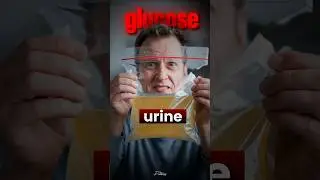 ⚠️ when there is too much Glucose in Urine - KIDNEY PROBLEMS