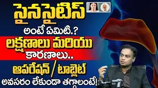 సైనసైటిస్ : What is sinusitis..? | Symptoms and causes.. | Sinusitis | Dr Bhardwaj | BRK Doctors