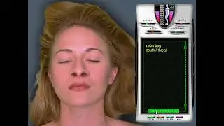 Emergency Room: Disaster Strikes - Case 213 - Trapped in fire (Alison Mann, Severe smoke inhalation)