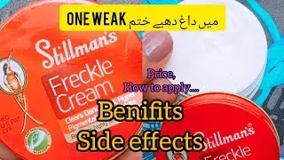 Stillmans Freckles Cream Review By Madiha Ki Duniya| How to get rid or Acne, Pimple and Dark Sport.