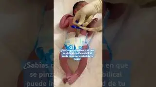 El pinzamiento tard&iacute;o permite que el beb&eacute; reciba el 30% m&aacute;s hierro y c&eacute;lulas madre de la placenta❤️