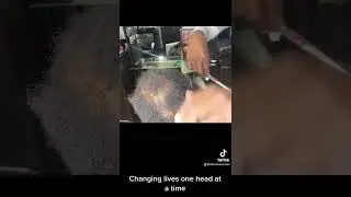 Atlanta HAIRLOSS client.. tour booking visit RAZORCHIC.COM