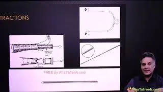 7  Spine + Pelvis + Lower Limb Traumatology 25  Fracture management