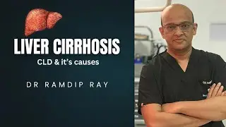 Liver Cirrhosis : CLD & it's causes || Dr Ramdip Ray || LIVER gi TV