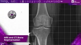 BODYCAD - PATIENT SPECIFIC SOLUTIONS