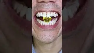 ASMR | Yellow Diamond Hard Candy 💎🍋 #DoctorTristanPeh #ASMR